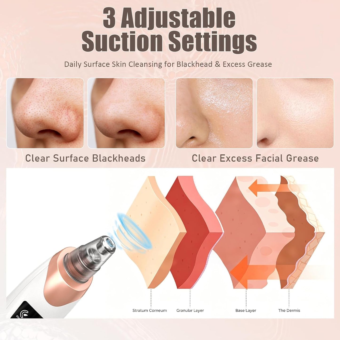 Electric Blackhead Remover Pore Vacuum With 5 Probes